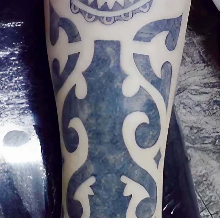 Eliminación profesional de tatuajes con la tecnología Laserlight